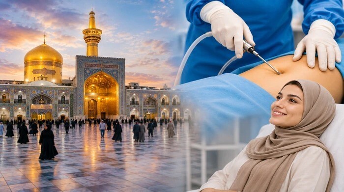 چرا مشهد گزینه اول عرب‌ها برای پیکرتراشی در ایران است؟